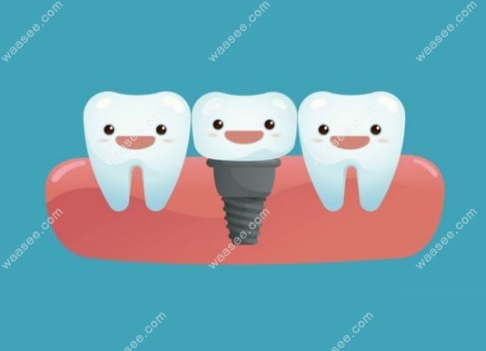牙科医院种植牙一般多少钱一颗