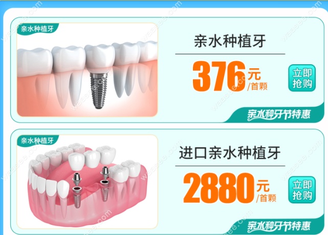广大口腔本月种牙优惠:亲水种植牙376元全包/补贴金高达1500