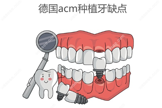 德国acm种植牙缺点
