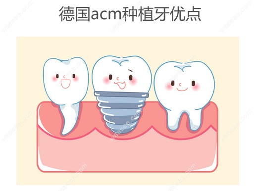 德国acm种植牙优点