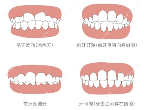 徐宝华正畸给加号吗