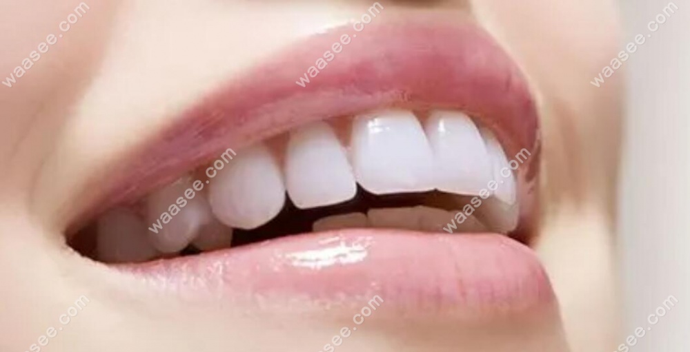 上海半口全瓷固定牙能用多长时间？