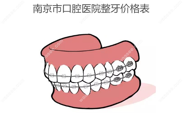 南京市口腔医院整牙价格表,郝静/刘超医生正畸费用4000+