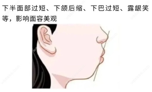 深覆合