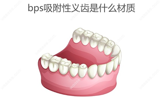 bps吸附性义齿是什么材质,全瓷和树脂组成的材料,全口价格2w+