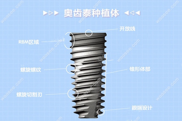 韩国奥齿泰种植牙特点waasee.com