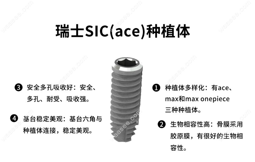 瑞士sic种植牙