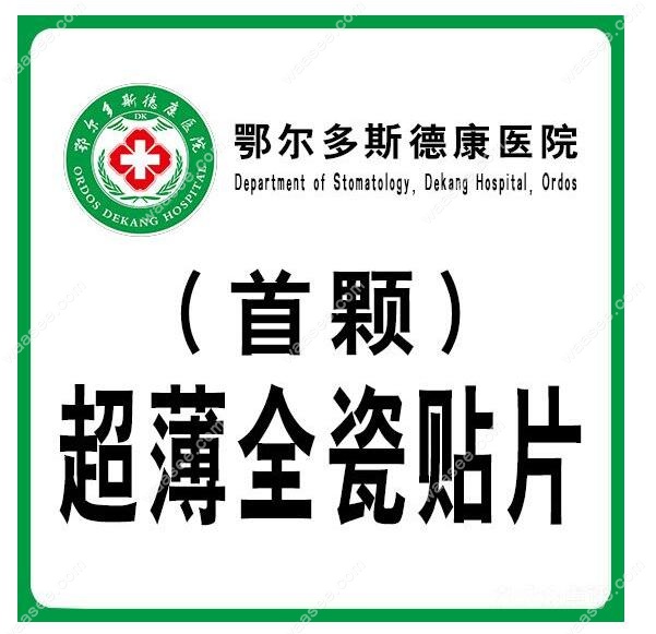 鄂尔多斯德康医院口腔科 瓷贴片
