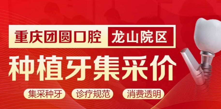 重庆龙山团圆口腔医院种牙便宜
