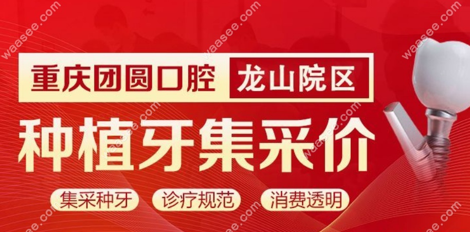 重庆龙山团圆口腔医院做种牙价格便宜