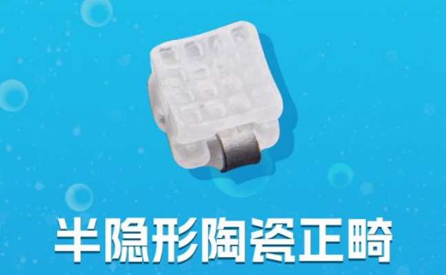 半隐形矫正