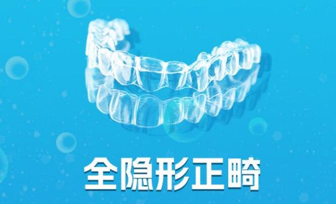 全隐形矫正