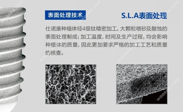 韩国仕诺康植体材料