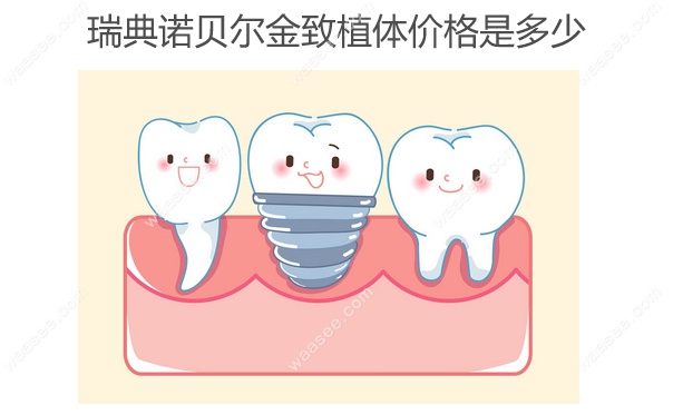 瑞典诺贝尔金致植体价格www.waasee.com