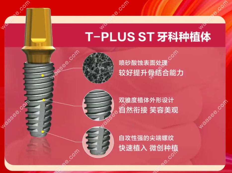 瑞士tplus种植体特点
