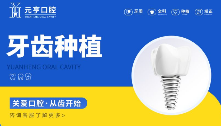 种植牙项目