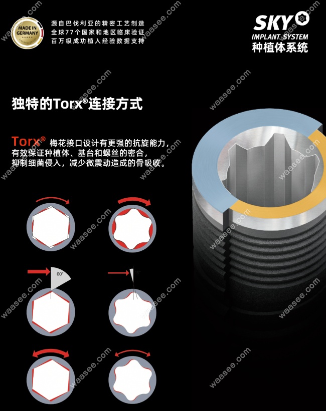 sky种植体的特殊设计与螺纹结构