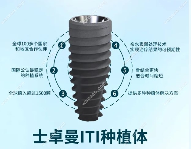 iti种植体价格
