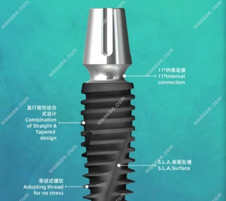 沃兰种植体系统