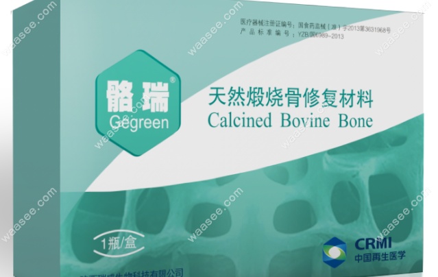 骼瑞骨粉是国产植骨材料，由牛骨制备而成