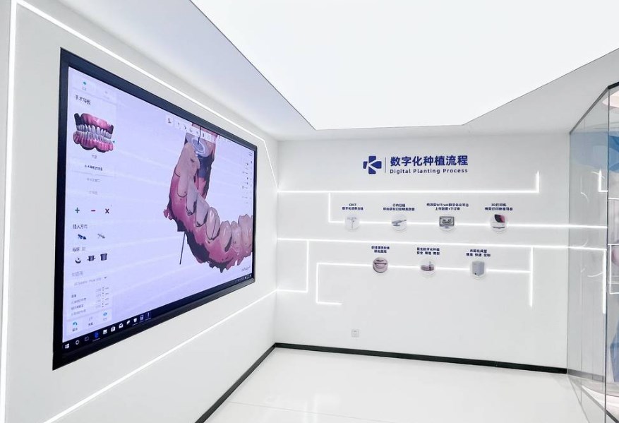 数字化种植牙流程