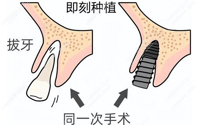 杨超医生坐诊在深圳慕义口腔