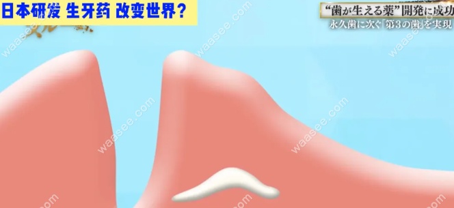 再生牙齿