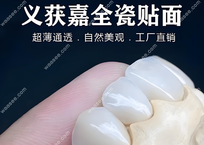 义获嘉全瓷贴面价格