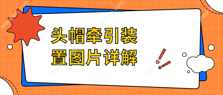 头帽牵引装置图片详解