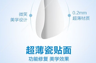 美学贴面
