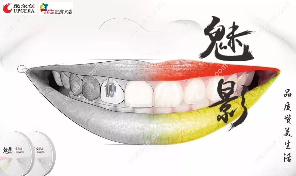 魅影是爱尔创全瓷牙中的高端品牌