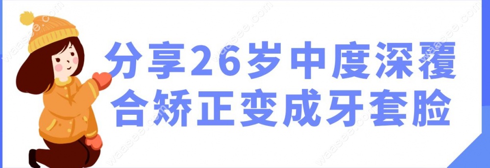 分享26岁中度深覆合矫正变成牙套脸