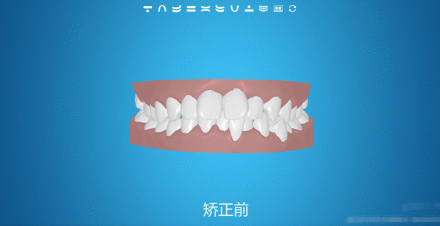 重庆多乐儿童齿科矫正
