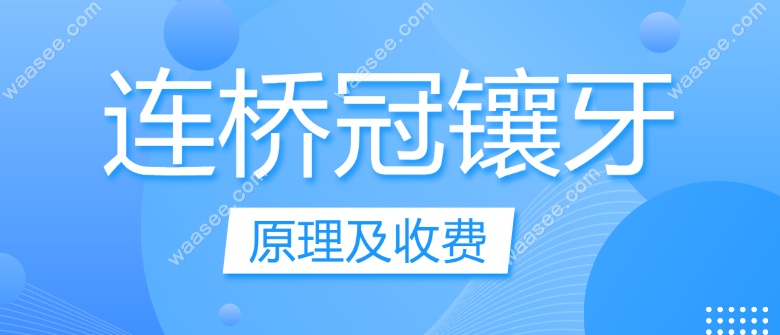 连冠桥镶牙原理及收费www.waasee.com