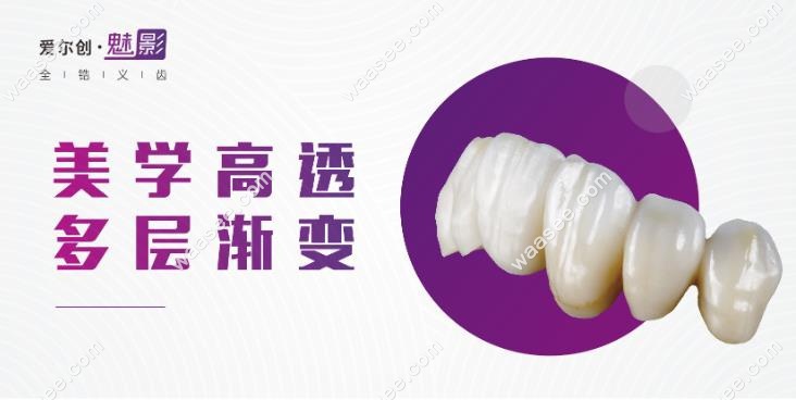 爱尔创魅影全瓷牙价格www.waasee.com