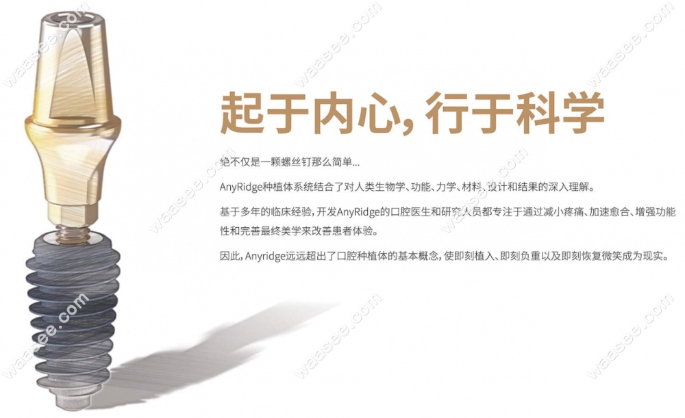 韩国美格真植体产品介绍