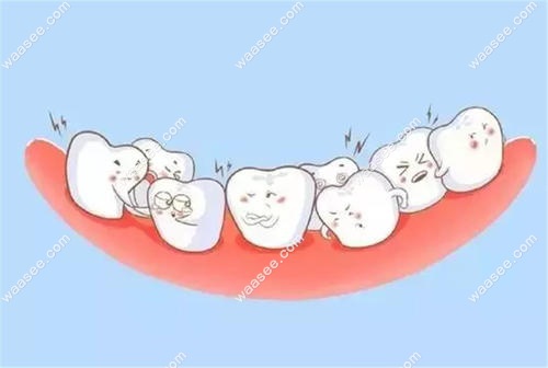 牙齿清洁不到的地方