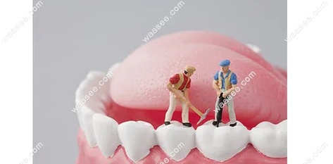 补牙示意图waasee.com