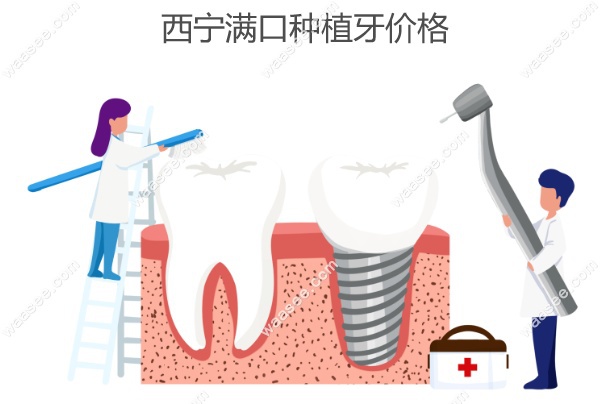 西宁满口种植牙价格