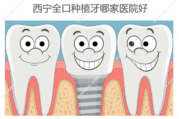西宁全口种植牙哪家医院好