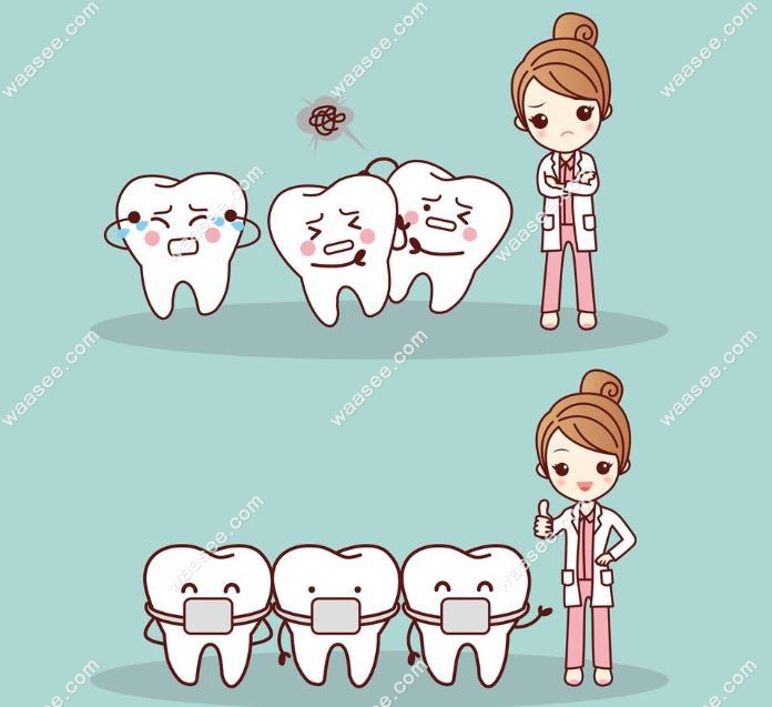 牙齿矫正示意图waasee.com