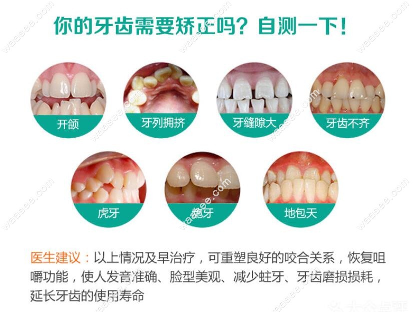 哪些牙齿畸形需要做矫正