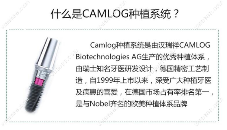 德国camlog种植体介绍