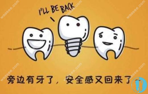 种植牙图片