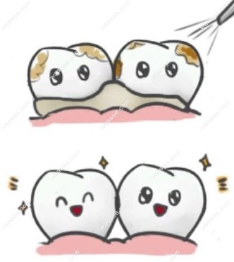 牙齿清洁