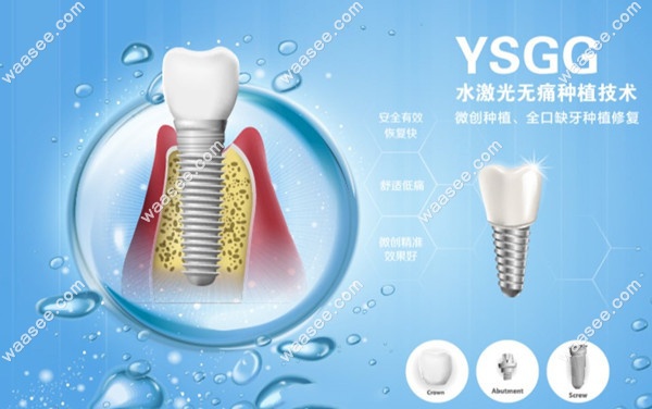 沈阳医科大口腔种植科好的大夫