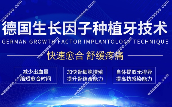 广州柏德齿科的德国生长因子种植牙技术优势