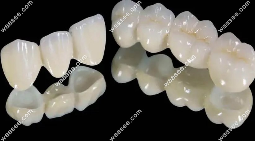 广州全瓷牙冠补牙www.waasee.com