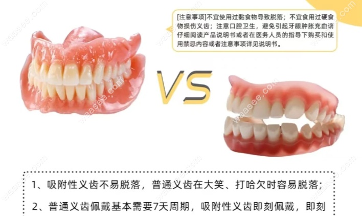 吸附性假牙