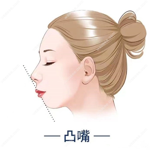 郑州唯美口腔矫正牙齿怎么样